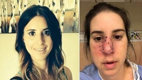 تزيل أنفها بالكامل بسبب آلامها المبرحة