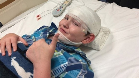 طفل يتحول إلى حجر بسبب حالة نادرة