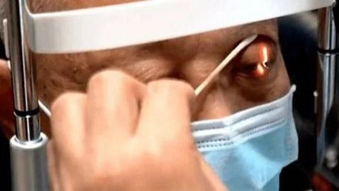 بسبب حالة نادرة... يذرف الدموع كلما تناول الطعام