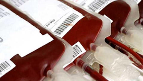 من بينهم دم الانسان...اليكم أغلى 10 سوائل في العالم