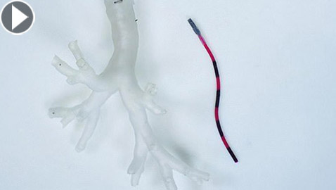 تطور علمي.. روبوت يخترق أنابيب الرئة ويأخذ عينات من الأنسجة!