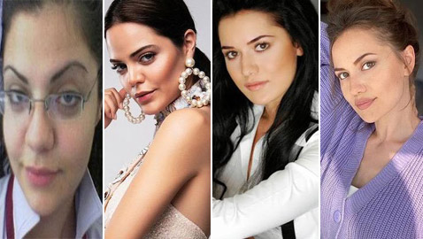 نجمات تركيا قبل وبعد التجميل.. لن تصدق الفرق!