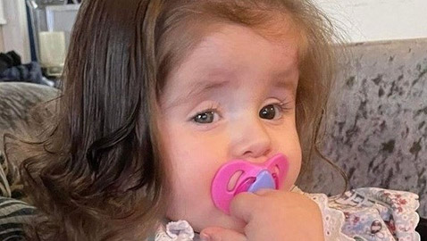 طفلة تأكل خصلات شعرها بسبب حالة صحية نادرة