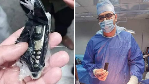 صور: استخراج هاتف محمول من بطن شاب مصري