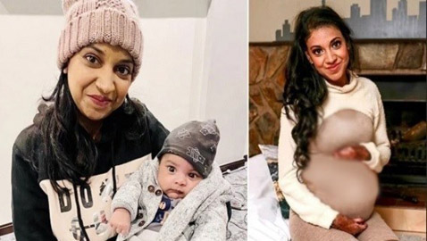 صور...تصاب بحروق شديدة أثناء المخاض بسبب حالة صحية نادرة