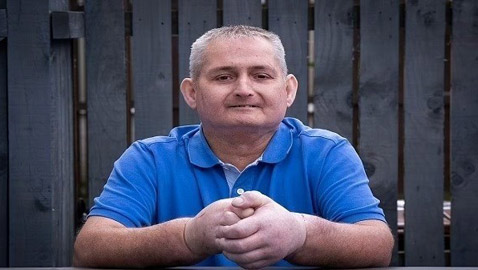 يخضع لأول عملية زرع يد مزدوجة في العالم بعدما أصيب بتصلب الجلد