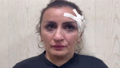 أم روسية تبيع رضيعها بـ3600 دولار.. لإجراء عملية تجميل لأنفها!
