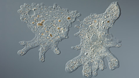 الأميبا آكلة الدماغ.. أكثر الطفيليات فتكا