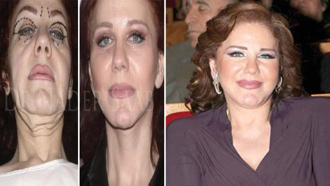 بالصور: ميادة الحناوي تبدو بالعشرينات بعد عملية تجميل تغير ملامحها