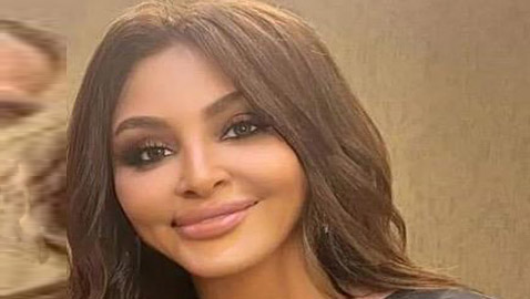 صور إليسا تصدم الجمهور بسبب عملية تجميل فاشلة لنفخ شفاهها
