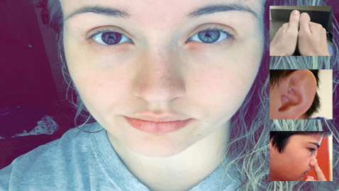 أشخاص لديهم سمات جسديّة أندر من الأمطار في الصحارى