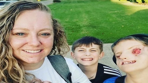 تشارك قصة طفلها الذي ولد بلا عينين .. والسبب؟