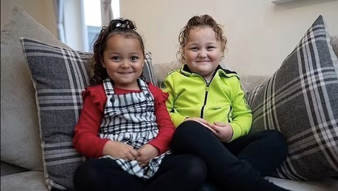 طفلتان توأم تولدان بلونين مختلفين وتنموان في رحمين منفصلين