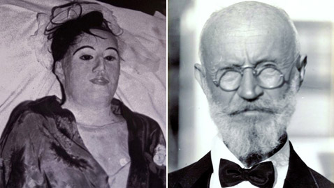 أحبها فحنطها وحاول إعادتها للحياة.. طبيب نمساوي عاش مع جثمان مريضته 7 سنوات!