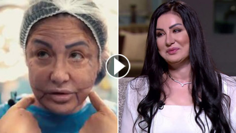 وفاء سالم تفجر مفاجآت عن عمليات التجميل في وجهها (فيديو)