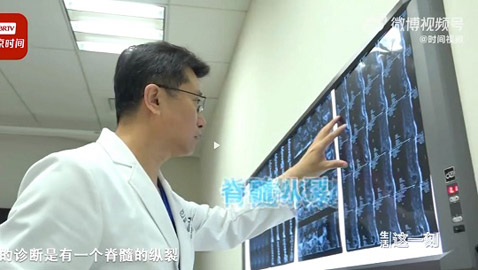 تكتشف أنها مصابة بمرض خطير بسبب كتلة شعر في ظهرها