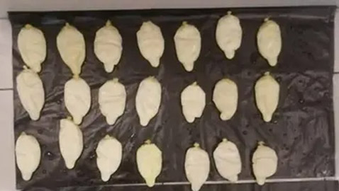 صور الأشعة فضحته.. حشر مخدرات في أمعائه للدخول إلى الأردن