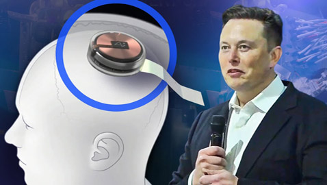 إيلون ماسك: بدء زرع رقاقة لاسلكية بدماغ الإنسان خلال 6 أشهر