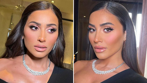 صور دينا الشربيني بعد عملية تجميل: وجهها منفوخ ومتغير والجمهور: 