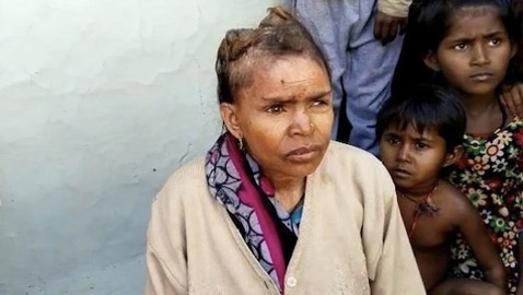 تحير الأطباء بـ 