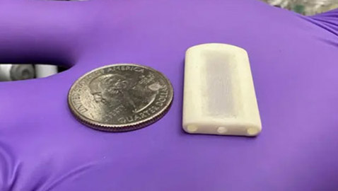 لا حاجة للحقن اليومية.. علاج مبتكر تحت الجلد لمرضى السكري