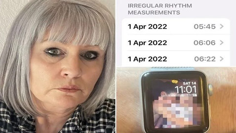 ساعة آبل تكشف إصابة سيدة بمرض خطير وتنقذها من الموت