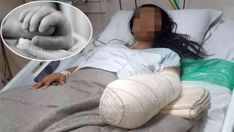 فرحة بمولود جديد تتحول لمأساة.. أم تخسر يدها بخطأ طبي!