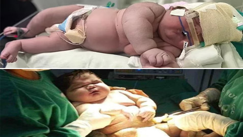 أضخم مولود في العالم! امرأة برازيلية تُنجب طفلا بوزن 
