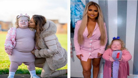 تمنع طفلتها من دخول المطبخ بسبب حالة نادرة