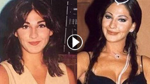  فيديو نادر: اليسا تغني (بدّي دوب) قبل عمليات التجميل.. التغيير صادم!