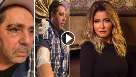 زوج علا غانم يفضحها: تتعاطى المخدرات هي وابنتها وضربتني بزجاجة نبيذ! فيديو