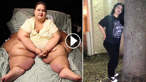 فيديو وصور لم تر مثلها من قبل! أثقل امرأة بالعالم تخسر 360 كيلو من وزنها!