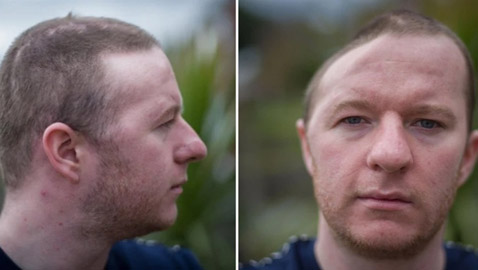 لكمة واحدة تُفقده نصف جمجمته !