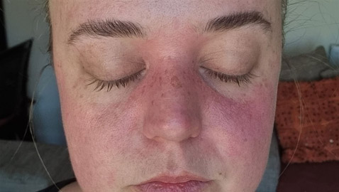 حالة نادرة تتسبب في غلق عينيها أثناء القيادة