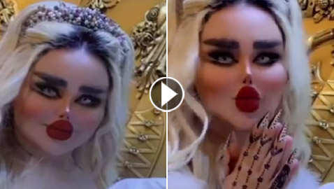 فيديو وصور: داليا نعيم بإطلالة صادمة بعد 43 عملية تجميل! 