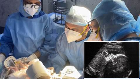 أطباء ينجحون بإجراء عملية جراحية بالمخ لجنين برحم أمه.. أنقذوا حياته!