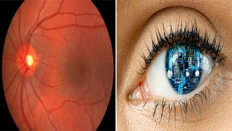 علاج جيني قد يعيد البصر للمكفوفين وراثيا!