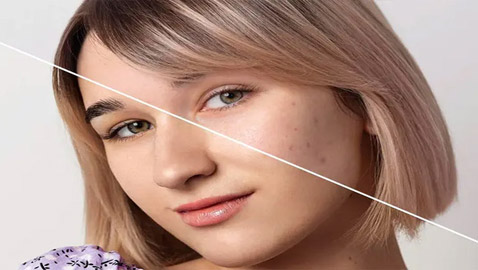 إليكم 8 حلول جذرية للقضاء على مشكلة توسع المسام