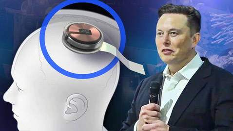 شريحة ماسك للأدمغة.. موافقة رسمية لبدء التجارب على البشر