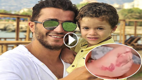 ‏فيديو صادم: ابن جورج الراسي يبكي متألما! من حرق جسمه؟ والدته جويل حاتم أم عمته؟