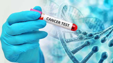 اختبار دم بسيط يساعد بمعرفة الإصابة بالسرطان ومن ثم سرعة التشخيص