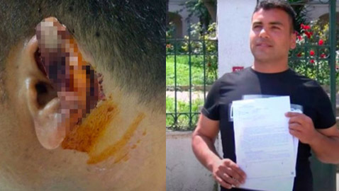 نورس يلتهم أذن رجل بعد شجار غريب في اسطنبول