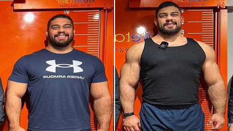 بعد شهور من الألم.. شاب أمريكي يحقق الحلم ويزيد طوله 17 سم