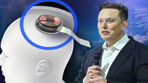 شريحة الدماغ المثيرة للجدل.. ماسك يكشف موعد أول زراعة للبشر