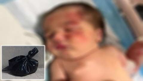 صدمة تهز لبنان.. كلب يجر كيس قمامة فيه رضيعة حديثة الولادة!