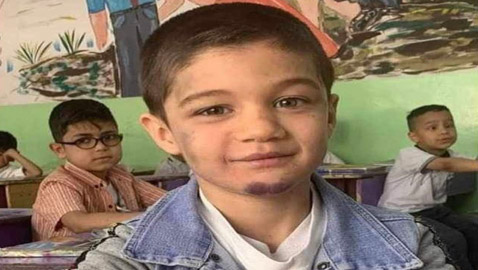 عذبته زوجة أبيه حتى الموت.. صورة تعصر القلب لطفل بغداد