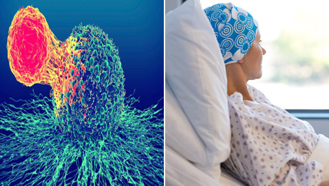 بُشرى لمصابي السرطان.. اكتشاف دواء حي فاعليته تصل إلى 80%