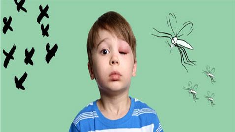 8 نصائح لتجنب لدغات البعوض في موسم الصيف والعطلات