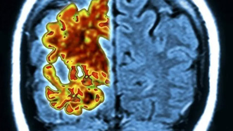 طالب يكشف فضيحة تطيح برئيس ثالث أقوى جامعة في العالم!