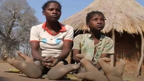 قبيلة غامضة بأقدام مشوهة تطورت لتسلق الأشجار